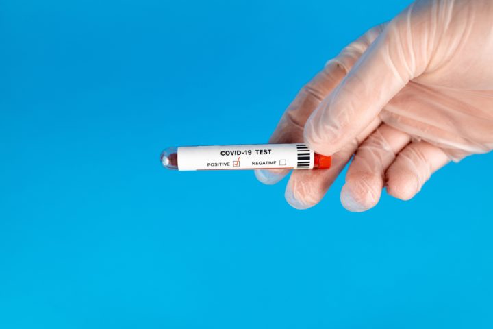 What happens if I test positive for COVID-19 before a trip?